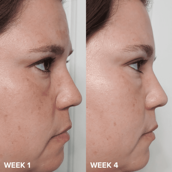 PAULA'S CHOICE exfoliant skin perfecting 2 bha 118ml – Image 7