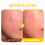 TirTir Pure Vitamin C24 Serum effects