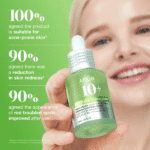 ANUA Azelaic Acid 10 Hyaluron Redness Soothing Serum 30 ml – Image 2