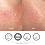 Dr Althea 345 Relief Cream - 50ml – Image 5